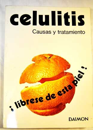 Celulitis Causas y tratamiento / Gerard J Leonard